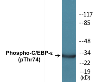 Western blot analysis of extracts from HuvEc cells treated with UV 15', using C/EBP-epsilon (Phospho-Thr74) Antibody.