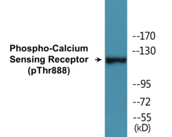 Western blot analysis of extracts from LOVO cells, using Calcium Sensing Receptor (Phospho-Thr888) Antibody.