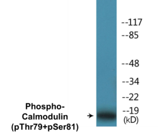 Western blot analysis of extracts from Jurkat cells treated with Insulin 0.01U/ml 15', using Calmodulin (Phospho-Thr79+Ser81) Antibody.