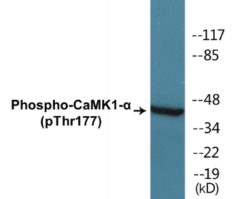 Western blot analysis of extracts from K562 cells treated with insulin 0.01U/ml 15' and Jurkat cells treated with insulin 0.01U/ml 15', using CaMK1-alpha (Phospho-Thr177) Antibody.