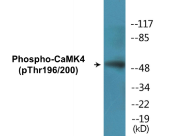 Western blot analysis of extracts from K562 cells treated with H2O2 100uM 30', using CaMK4 (Phospho-Thr196/200) Antibody.
