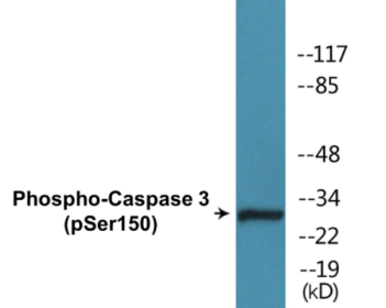 Western blot analysis of extracts from Jurkat cells treated with Etoposide 25uM 60', using Caspase 3 (Phospho-Ser150) Antibody.
