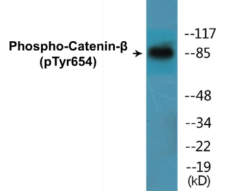 Western blot analysis of extracts from 293 cells, using Catenin-beta (Phospho-Tyr654) Antibody.