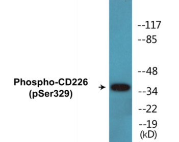 Western blot analysis of extracts from COS7 cells, using CD226/DNAM-1 (Phospho-Ser329) Antibody.