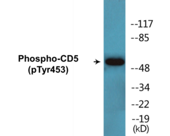 Western blot analysis of extracts from 293 cells treated with PMA 125ng/ml 30' , using CD5 (Phospho-Tyr453) Antibody.