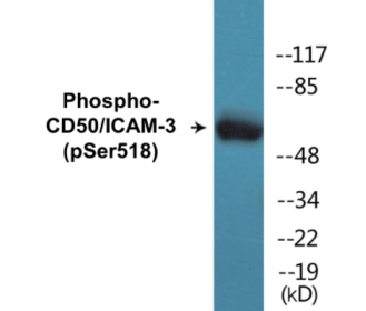 Western blot analysis of extracts from HepG2 cells treated with TNF, using CD50/ICAM-3 (Phospho-Ser518) Antibody.