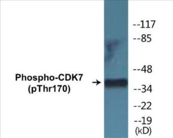 Western blot analysis of extracts from HeLa cells treated with Calyculin A 50nM 30', using CDK7 (Phospho-Thr170) Antibody.