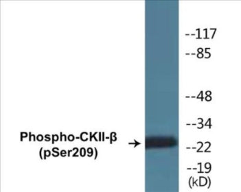 Western blot analysis of extracts from HuvEc cells, using CKII-beta (Phospho-Ser209) Antibody.