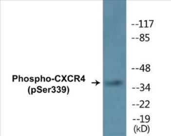 Western blot analysis of extracts from HuvEc cells treated with etoposide 25uM 24H, using CXCR4 (Phospho-Ser339) Antibody.