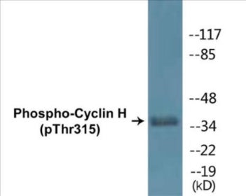 Western blot analysis of extracts from HepG2 cells, Jurkat cells, HuvEc cells and A549 cells, using Cyclin H (Phospho-Thr315) Antibody.