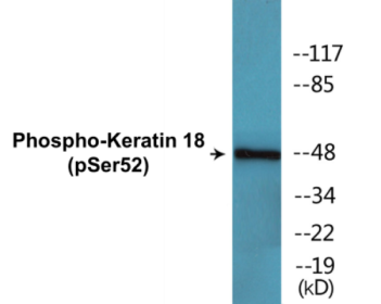 Western blot analysis of extracts from HepG2 cells, using Keratin 18 (Phospho-Ser52) Antibody.