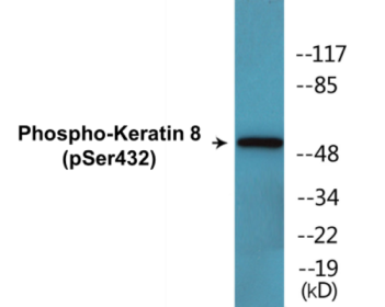 Western blot analysis of extracts from 293 cells treated with EGF 200ng/ml 30', using Keratin 8 (Phospho-Ser432) Antibody.