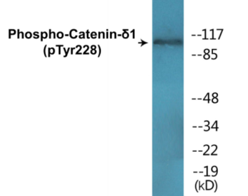 Western blot analysis of extracts from HuvEc cells, using Catenin-delta1 (Phospho-Tyr228) Antibody.