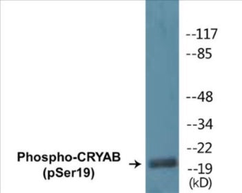 Western blot analysis of extracts from HepG2 cells treated with nocodazole 1ug/ml 16h, using CRYAB (Phospho-Ser19) Antibody.