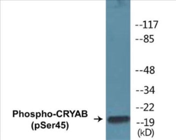 Western blot analysis of extracts from COS7 cells treated with anisomycin 25ug/ml 30', using CRYAB (Phospho-Ser45) Antibody.