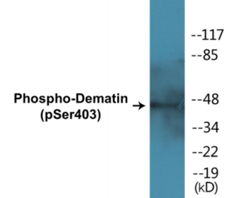 Western blot analysis of extracts from HepG2 cells treated with Insulin 0.01U/ml 15', using Dematin (Phospho-Ser403) Antibody.