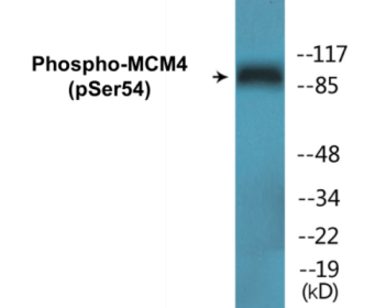 Western blot analysis of extracts from COS7 cells treated with nocodazole 1ug/ml 16h, using MCM4 (Phospho-Ser54) Antibody.