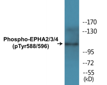 Western blot analysis of extracts from HepG2 cells, using EPHA2/3 (Phospho-Tyr588/596) Antibody.