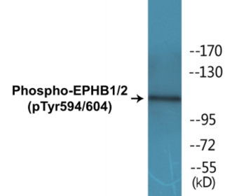 Western blot analysis of extracts from HepG2 cells, using EPHB1/2 (Phospho-Tyr594/604) Antibody.