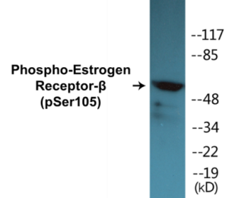 Western blot analysis of extracts from HeLa cells, using Estrogen Receptor-beta (Phospho-Ser105) Antibody.