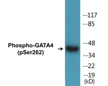 Western blot analysis of extracts from 293 cells, using GATA4 (Phospho-Ser262) Antibody.