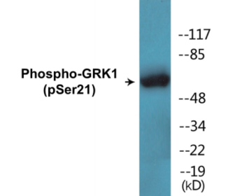 Western blot analysis of extracts from COS7 cells treated with TNF 20ng/ml 5', using GRK1 (Phospho-Ser21) Antibody.