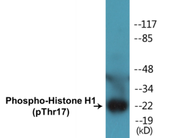 Western blot analysis of extracts from Jurkat cells treated with UV 15', using Histone H1 (Phospho-Thr17) Antibody.