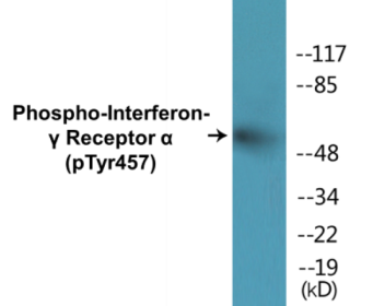 Western blot analysis of extracts from COS7 cells, using Interferon-gamma Receptor alpha (Phospho-Tyr457) Antibody.