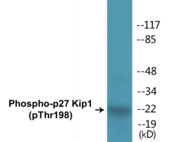 Western blot analysis of extracts from HeLa cells, HepG2 cells and COLO cells, using p27 Kip1 (Phospho-Thr198) Antibody.
