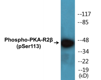 Western blot analysis of extracts from COS7 cells treated with PMA 125ng/ml 30', using PKA-R2 beta (Phospho-Ser113) Antibody.