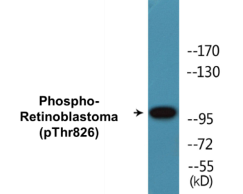 Western blot analysis of extracts from HepG2 cells treated with nocodazole 1ug/ml 16h, using Retinoblastoma (Phospho-Thr826) Antibody.