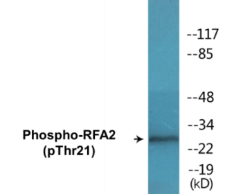 Western blot analysis of extracts from HeLa cells treated with Adriamycin 0.5ug/ml 24h, using RFA2 (Phospho-Thr21) Antibody.