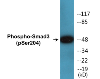Western blot analysis of extracts from NIH-3T3 cells treated with Serum 20% 15', using Smad3 (Phospho-Ser204) Antibody.