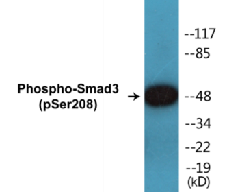 Western blot analysis of extracts from Jurkat cells, using Smad3 (Phospho-Ser208) Antibody.