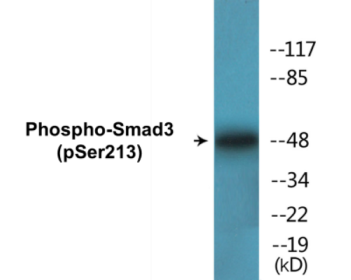 Western blot analysis of extracts from HT29 cells, using Smad3 (Phospho-Ser213) Antibody.