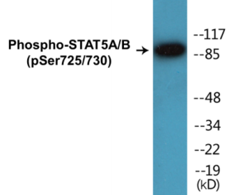 Western blot analysis of extracts from Jurkat cells treated with EGF 200ng/ml 30', using STAT5A/B (Phospho-Ser725/730) Antibody.