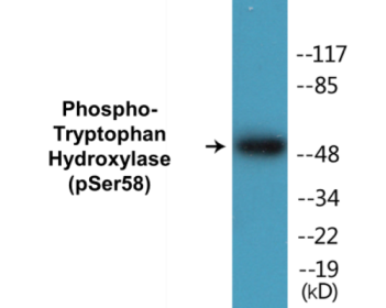 Western blot analysis of extracts from 293 cells treated with paclitaxel 1uM 24h, using Tryptophan Hydroxylase (Phospho-Ser58) Antibody.