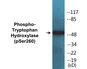 Western blot analysis of extracts from Jurkat cells and HepG2 cells, using Tryptophan Hydroxylase (Phospho-Ser260) Antibody.