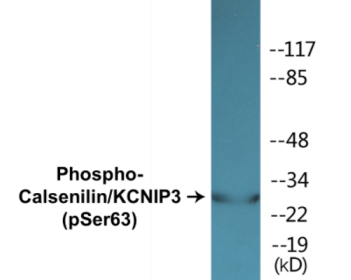 Western blot analysis of extracts from K562 cells treated with forskolin 40nM 30' and 293 cells treated with PMA 125ng/ml 30', using Calsenilin/KCNIP3 (Phospho-Ser63) Antibody.