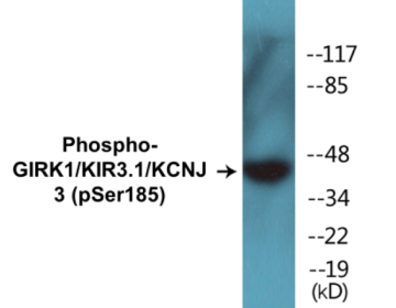 Western blot analysis of extracts from RAW264.7 cells treated with Insulin 0.01U/ml 15', using GIRK1/KIR3.1/KCNJ3 (Phospho-Ser185) Antibody.