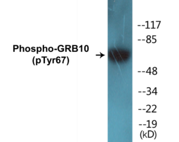Western blot analysis of extracts from COS7 cells, using GTPase Activating Protein (Phospho-Ser387) Antibody.