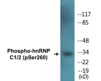 Western blot analysis of extracts from 293 cells treated with H2O2 100uM 15', using hnRNP C1/2 (Phospho-Ser260) Antibody.