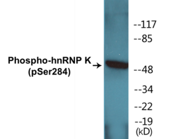 Western blot analysis of extracts from NIH-3T3 cells treated with EGF 200ng/ml 30', using hnRNP K (Phospho-Ser284) Antibody.