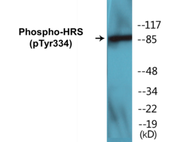 Western blot analysis of extracts from HepG2 cells treated with PMA 125ng/ml 30', using HRS (Phospho-Tyr334) Antibody.
