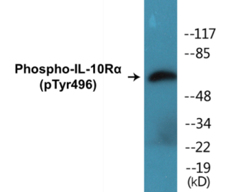 Western blot analysis of extracts from HuvEc cells, using IL-10R alpha (Phospho-Tyr496) Antibody.