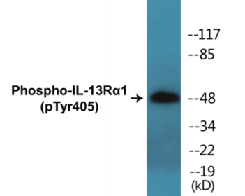 Western blot analysis of extracts from HuvEc cells treated with serum 20% 15', using IL-13R alpha1 (Phospho-Tyr405) Antibody.