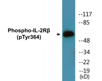 Western blot analysis of extracts from HeLa cells, using IL-2R beta (Phospho-Tyr364) Antibody.