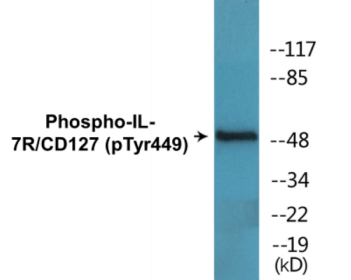 Western blot analysis of extracts from COLO205 cells, using IL-7R/CD127 (Phospho-Tyr449) Antibody.