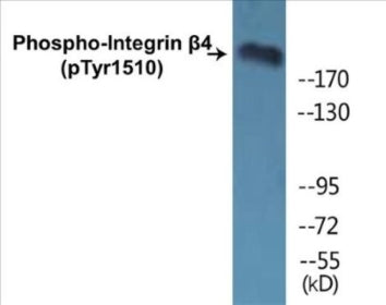 Western blot analysis of extracts from HepG2 cells treated with Na2VO3 0.3nM 40', using ITGB4 (Phospho-Tyr1510) Antibody.