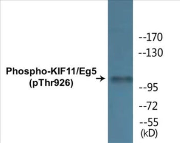 Western blot analysis of extracts from COLO205 cells, using KIF11/Eg5 (Phospho-Thr926) Antibody.